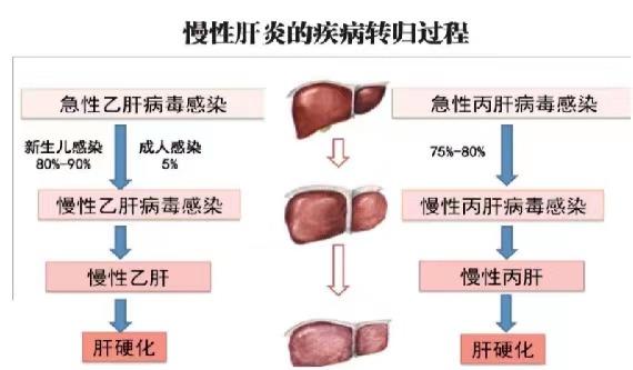 【健康科普】世界肝炎日——堅(jiān)持早預(yù)防，加強(qiáng)檢測發(fā)現(xiàn)，規(guī)范抗病毒治療